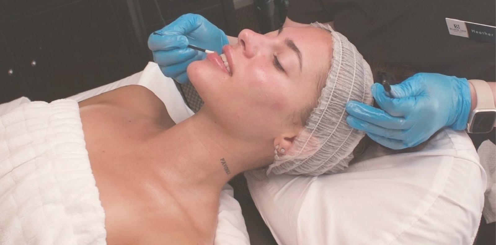 lip filler Lewisville