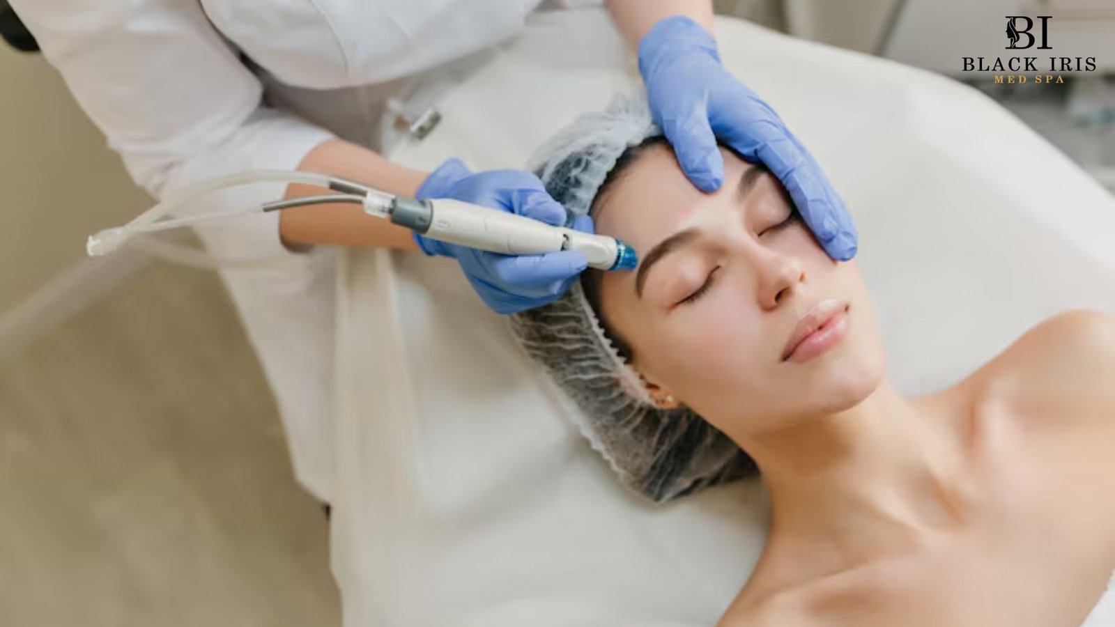 rf microneedling dallas tx
