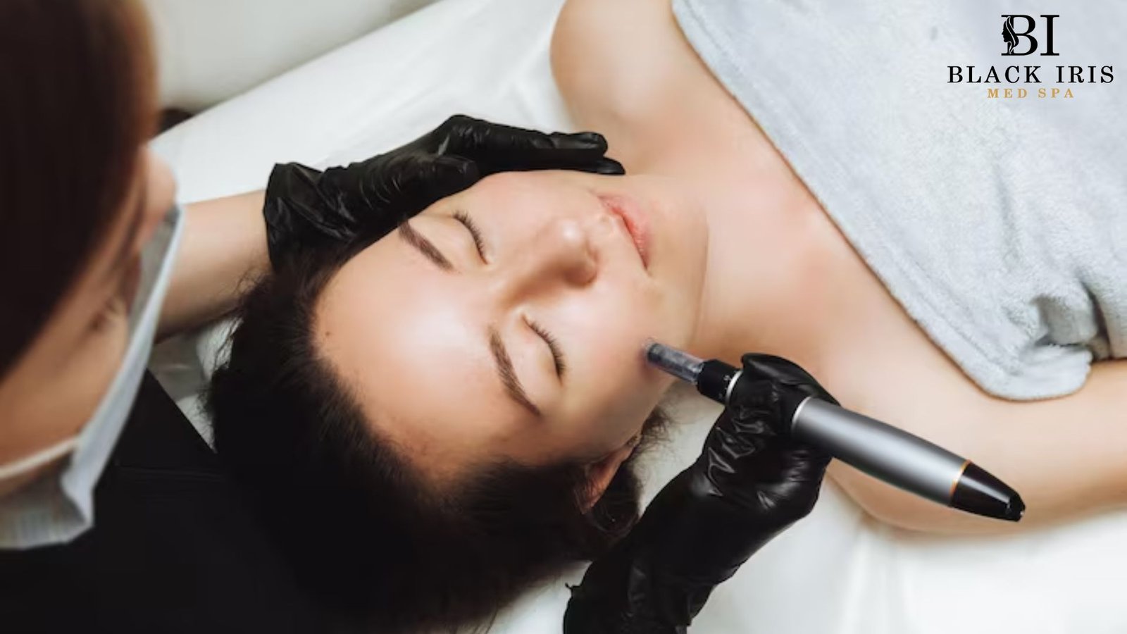 microneedling in Plano