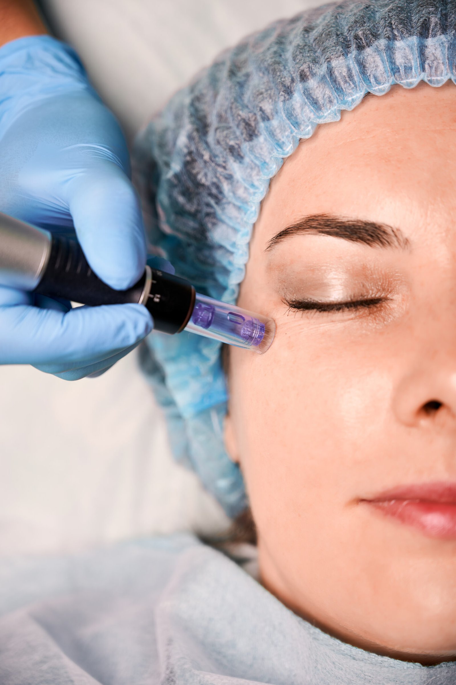 best microneedling Coppell