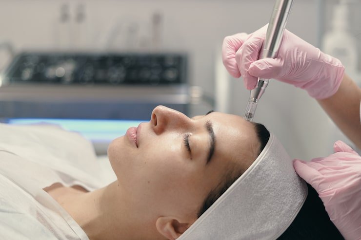 microneedling frisco tx