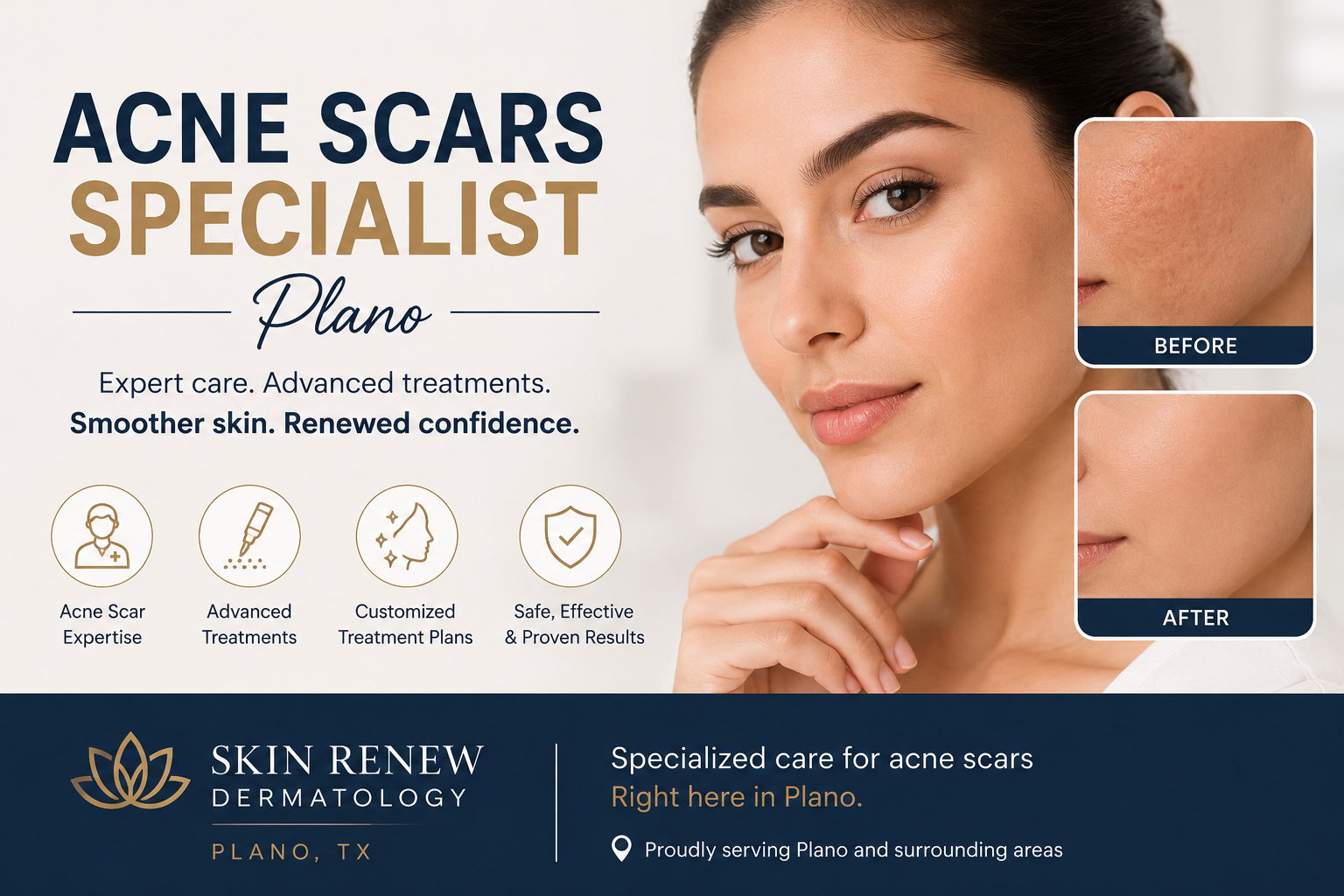 acne scars specialist Plano