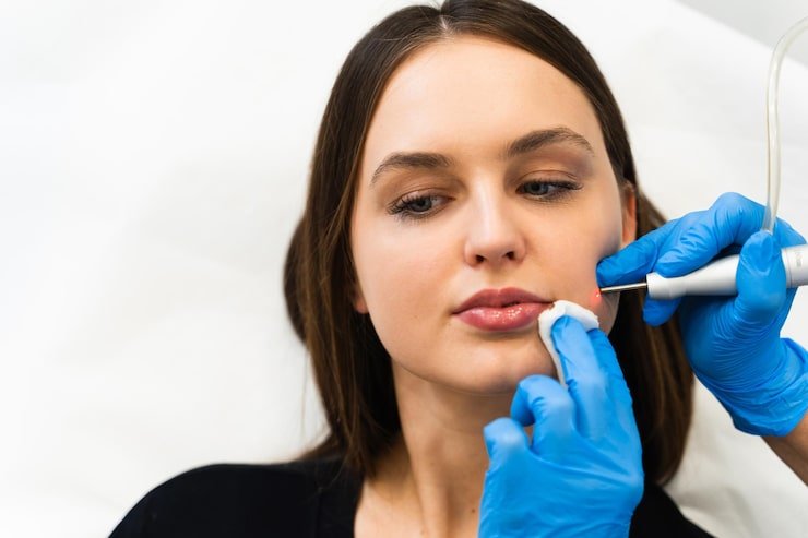 lip fillers Lewisville Texas