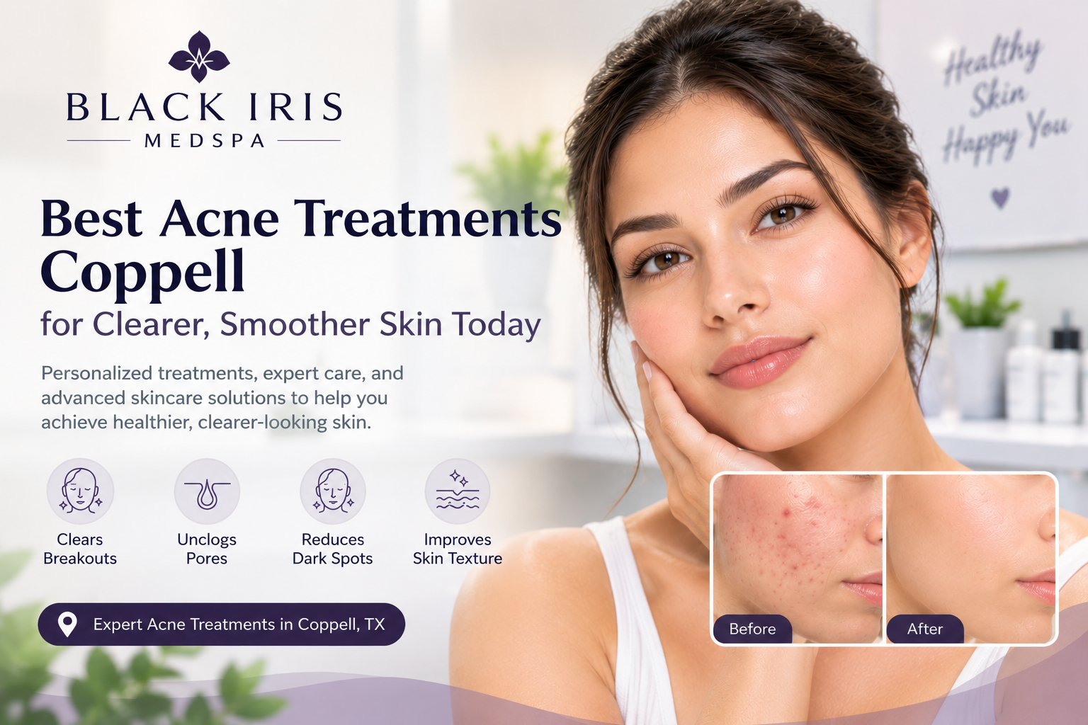Best Acne Treatments Coppell for Clearer, Smoother Skin Today