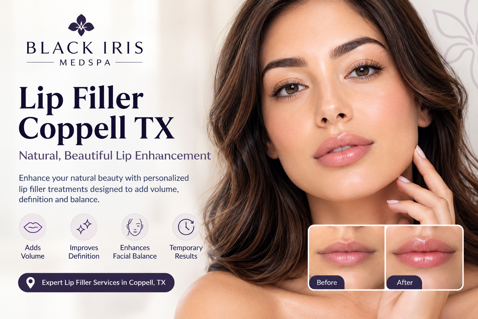 Elegant Lip Filler Clinic Advertisement